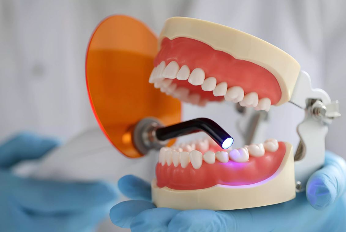 دندان‌های زیبایی